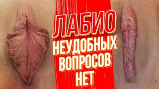 Пластика малых и больших половых губ (лабиопластика)