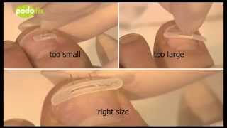 Podofix Ingrown Toenail Correction Braces - Distributed by Toes & Fingers in Ireland