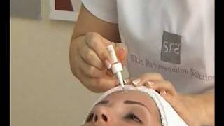 SRS  -  PRESENTATION  ROLLER  AND  MASK