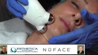 NuFace Trinity PRO San Diego | Del Mar