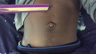 Navel Tortue- Slapping Belly with a Ruler