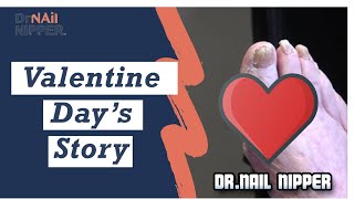 Valentine's Day Story and Trimming Long Toenails [Friday] (2020)