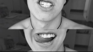 PIERCING NO SMILE - DOR, CUIDADOS E CICATRIZAÇÃO