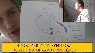 Jak opravit nechutný želví krk (Horní zkřížený syndrom)