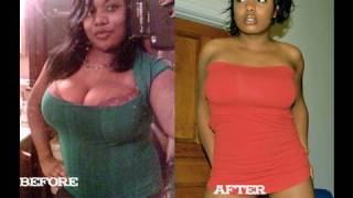 My 40lb Weight loss Before & After