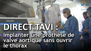 Direct TAVI : Poser une prothèse de valve aortique sans ouvrir le thorax