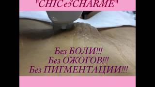 Лазерная эпиляция бикини