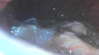 Stomach Cam 3 REUPLOAD