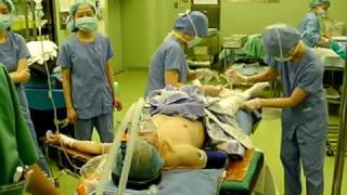 全身麻酔　導入　2  general anesthesia