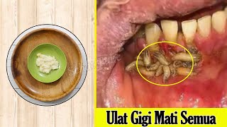 SETELAH TAHU RESEP INI, ULAT GIGI MUZNAH DAN SAKIT GIGI LANGSUNG SEMBUH TANPA OBAT KIMIA