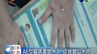 創7年高峰! 每天310人腸病毒急診