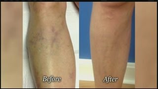 Goodman Vein and Laser Center