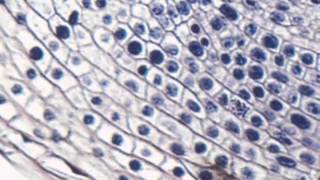 Onion root tip