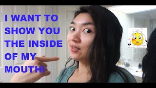 I Want To Show You The Inside Of My Mouth 5-7-16 Vlog