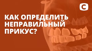 Неправильный прикус зубов: признаки и последствия – Эксперимент