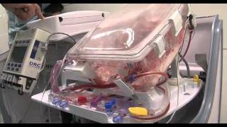 Heart in a Box: UCLA patient's life-saving donor heart arrives 'warm and beating' inside box