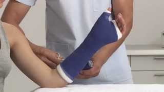 Plaster of Paris Scaphoid Splint Application
