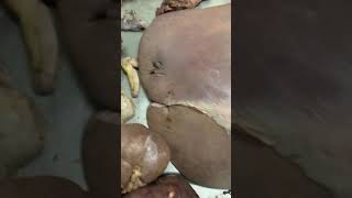 The Autopsy of a 29 year old female