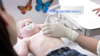 CX50 xMATRIX   Introducing CompactXtreme Ultrasound System CX50 xMATRIX   Portable Echocardiography