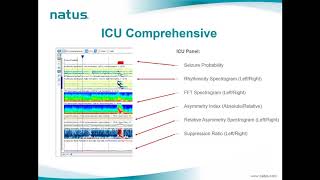 Natus EEG Webinar: NeuroWorks & Persyst Advanced ICU Solution