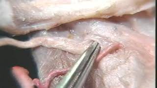 局部解剖学【咽和喉部解剖】Regional Anatomy [Pharynx and Larynx Anatomy]