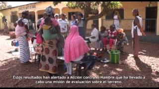 Combatiendo la desnutrición en Labé, Guinea