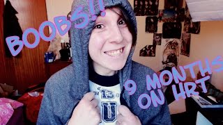 9 Months on Hormones! (MTF HRT, Breast Development, Fat Distribution and more)