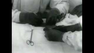 Prostatectomy.  Dr.  Wirt Dakin.  1916.