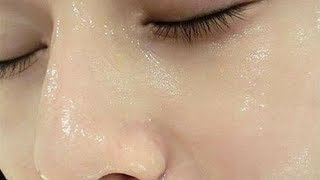 Hàng triệu người đã lột sạch mụn đầu đen ở mũi và cằm thành công chỉ với cách này