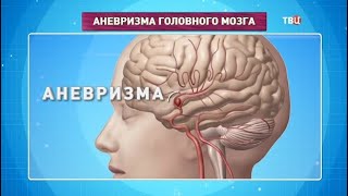 Аневризма. Доктор И...