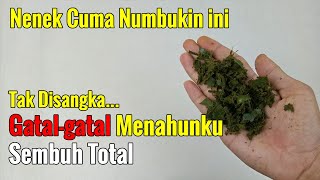 PAKAI INI DAN ITU BELUM JUGA SEMBUH, TERYATA HANYA PAKAI INI GATAL-GATALKU SEMBUH ALAMI