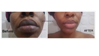 How to brighten dark lips and get natural pink lips