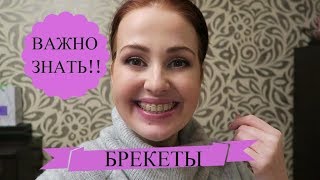 VLOG БРЕКЕТЫ Моя история// Почему ВАЖНА ВЫСОТА установки системы♥MarieDeMer