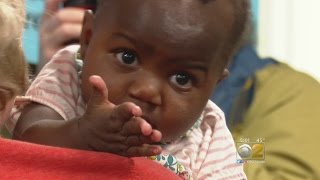 Advocate Doctors Help Baby Born With Four Legs, Two Spines