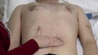 Abdominal Examination