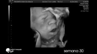 Реакция детей в утробе матери на музыку / The reaction of the children in the womb to the music
