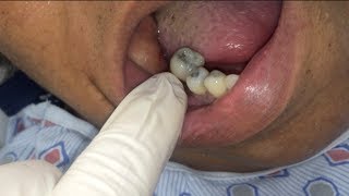 tooth fairy ER style