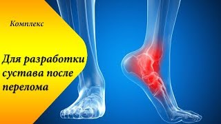 как быстро восстановить голеностоп после перелома