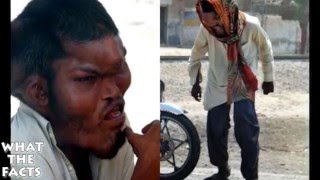 ШОК! 5 УЖАСНЫХ ГЕНЕТИЧЕСКИХ МУТАЦИЙ