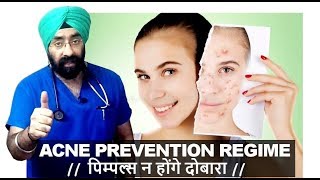 Rx Pimple #3 (Hindi) पिम्पल्स न होंगे दोबारा | FULL DAY  ROUTINE TO PREVENT ACNE | Dr.Education