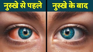 आँखों कि जलन और थकान को दूर करने का सस्ता और असरदार नुस्खा | How To Cure Eye Inflammation Naturally