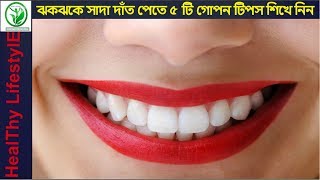 ঝকঝকে সাদা দাঁত পেতে ৫ টি গোপন টিপস শিখে নিন