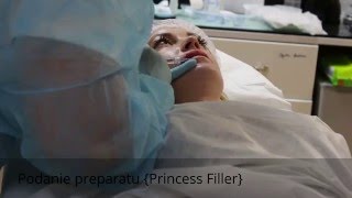 Salon CHIC Powiększanie ust kwasem hialuronowym {Princess Filler}