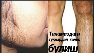 ТАБИИЙ УСУЛДА КУЛТИК ОСТИ ЮЗ КУЛ СОХАСИ ТУКЛАРДАН ХАЛОС БУЛИШ