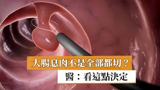 【劉建國醫師】大腸息肉不是全部都切？　醫：看這點決定