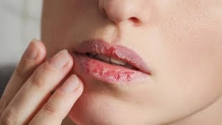 ХИТРЫЙ ТРЮК, как быстро восстановить СУХИЕ, ОБВЕТРЕННЫЕ губы