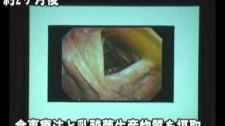 ノアの箱船　KS乳酸菌生産物質