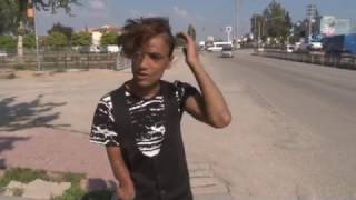 Esad'ın Bombası İsmail'i Bu Hale Getirdi