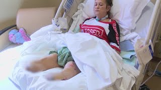 Woman recovering from amputations after pneumonia