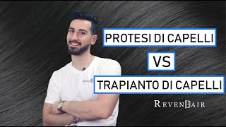 Protesi di capelli VS trapianto di capelli